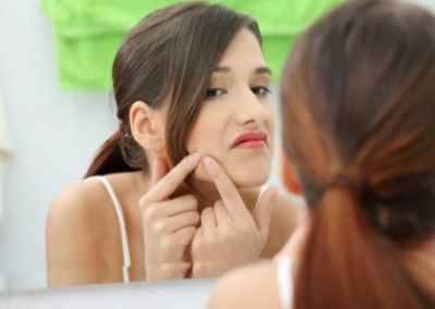 Seven Weird Ways To Zap A Zit!