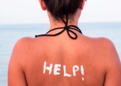 Sunburnt? Here's How to Suffer LESS and Heal FASTER!