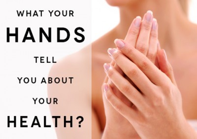 5 Things your hands are telling you about your health